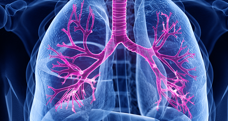 Optimizing COPD Care: Latest Guideline Changes & Clinical Insights